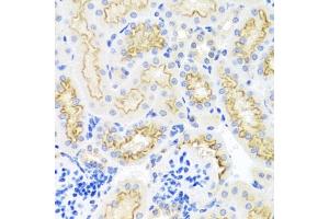 Immunohistochemistry of paraffin-embedded mouse kidney using SRPX antibody  at dilution of 1:100 (40x lens). (SRPX anticorps  (AA 40-320))