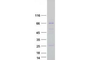 Validation with Western Blot (SLC27A2 Protein (Myc-DYKDDDDK Tag))