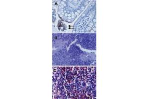 IHC analysis of TLR3 in (A) human gut lumen (longitudinal section, transverse region). (TLR3 anticorps  (AA 55-85))