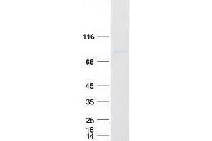 Validation with Western Blot