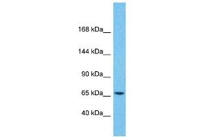 Host:  Rabbit  Target Name:  ZNF681  Sample Type:  Pancreas Tumor lysates  Antibody Dilution:  1. (ZNF681 anticorps  (Middle Region))