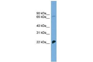 WB Suggested Anti-SLC5A5 Antibody Titration: 0. (SLC5A5 anticorps  (N-Term))