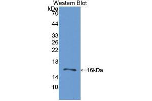 Western blot analysis of the recombinant protein. (GRPR anticorps  (AA 1-114))