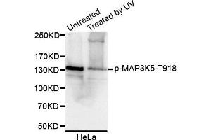 Western blot analysis of extracts of HeLa cell line, using Phospho-MAP3K5-T918 antibody. (ASK1 anticorps  (pThr918))