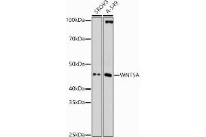 Western blot analysis of extracts of various cell lines, using WNT5A antibody (ABIN3023002, ABIN3023003, ABIN3023004 and ABIN6219340) at 1:1000 dilution. (WNT5A anticorps  (AA 101-380))