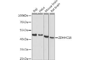 Western blot analysis of extracts of various cell lines, using ZDHHC18 Rabbit pAb (ABIN7271549) at 1:1000 dilution.