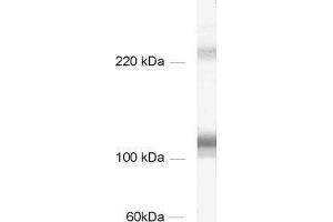 dilution: 1 : 1000, sample: rat brain homogenate