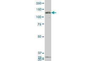 GUCY2C monoclonal antibody (M02), clone 1B11 Western Blot analysis of GUCY2C expression in 293 .