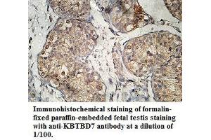 Image no. 1 for anti-Kelch Repeat and BTB (POZ) Domain Containing 7 (KBTBD7) antibody (ABIN1577435) (KBTBD7 anticorps)