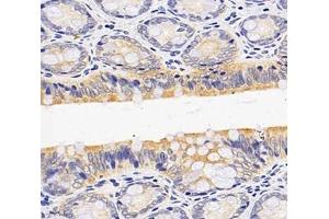 Immunohistochemistry analysis of paraffin-embedded rat colon using,OAS3 (ABIN7072846) at dilution of 1: 4000 (OAS3 anticorps)