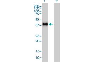 Western Blot analysis of GRAP2 expression in transfected 293T cell line by GRAP2 monoclonal antibody (M01), clone 1G12.