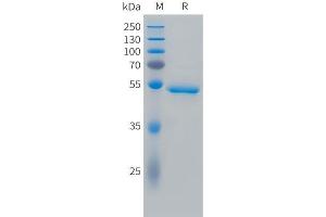 Cynomolgus CA9 Protein, His Tag on SDS-PAGE under reducing condition.