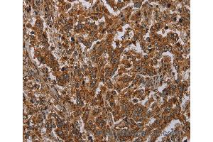 Immunohistochemistry of Human brain  using ATP2A1 Polyclonal Antibody at dilution of 1:30