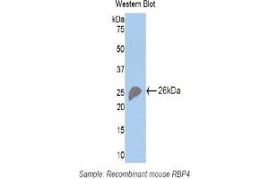 Detection of Recombinant RBP4, Mouse using Polyclonal Antibody to Retinol Binding Protein 4 (RBP4)