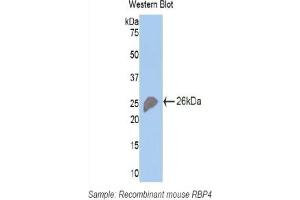 Detection of Recombinant RBP4, Mouse using Polyclonal Antibody to Retinol Binding Protein 4 (RBP4) (RBP4 anticorps  (AA 63-245))