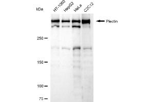 anti-Plectin (PLEC) antibody