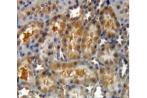 IHC-P analysis of Kidney tissue, with DAB staining. (LGALS8 anticorps  (AA 151-316))