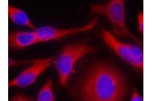 Immunofluorescence staining of methanol-fixed Hela cells using PKD/PKCm(Phospho-Ser738) Antibody. (PKC mu anticorps  (pSer738))