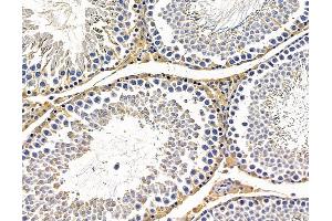 ABIN7096440 and ABIN7100504 at 1/100 staining rat testis tissue by IHC-P. (SPG7 anticorps)