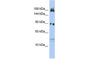 Human OVCAR3; WB Suggested Anti-AFF2 Antibody Titration: 0. (AFF2 anticorps  (N-Term))