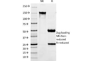SDS-PAGE Analysis Purified CD171 Mouse Monoclonal Antibody (SPM275). (L1CAM anticorps)