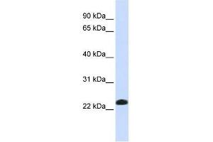 Western Blot showing CAV2 antibody used at a concentration of 1-2 ug/ml to detect its target protein. (Caveolin 2 anticorps  (N-Term))