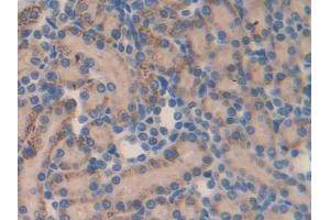 DAB staining on IHC-P; Samples: Rat Kidney Tissue (MMP23A anticorps  (AA 71-383))