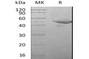 Western Blotting (WB) image for Plasminogen Activator Inhibitor 1 (SERPINE1) protein (His tag) (ABIN7320628)