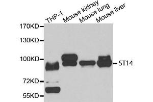 Western Blotting (WB) image for anti-Suppression of Tumorigenicity 14 (Colon Carcinoma) (ST14) antibody (ABIN1877121) (ST14 anticorps)