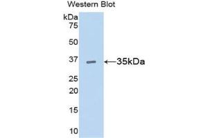 Detection of Recombinant CCND1, Rat using Polyclonal Antibody to Cyclin D1 (CCND1) (Cyclin D1 anticorps  (AA 1-295))