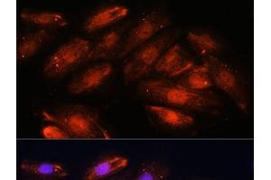Immunofluorescence analysis of H9C2 cells using OTUB1 Polyclonal Antibody at dilution of 1:100. (OTUB1 anticorps)