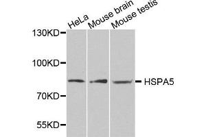 Western blot analysis of extracts of various cell lines, using HSPA5 antibody. (GRP78 anticorps  (AA 550-650))