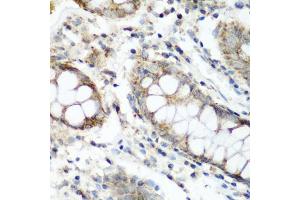 Immunohistochemistry of paraffin-embedded human colon using N antibody (ABIN6133455, ABIN6144330, ABIN6144331 and ABIN6223249) at dilution of 1:200 (40x lens). (NAT15 anticorps  (AA 1-242))
