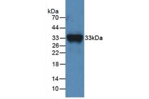 Detection of Recombinant F11, Mouse using Polyclonal Antibody to Coagulation Factor XI (F11) (Factor XI anticorps  (AA 157-389))
