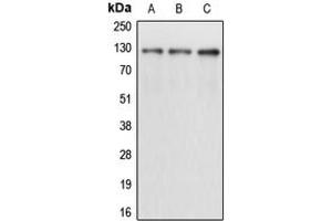 Western blot analysis of CD167a expression in A431 (A), K562 (B), T47D (C) whole cell lysates. (DDR1 anticorps  (Center))