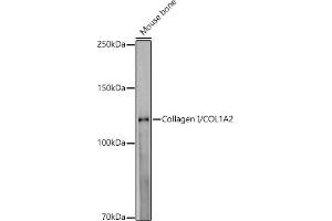 Western blot analysis of extracts of Mouse bone, using Collagen I/COL1 antibody (1059) at 1:1000 dilution. (COL1A2 anticorps)