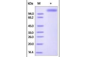 Influenza A [A/Shanghai/2/2013(H7N9)] HA, Fc Tag on SDS-PAGE under reducing (R) condition.