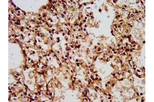 IHC image of ABIN7175834 diluted at 1:500 and staining in paraffin-embedded human lung tissue performed on a Leica BondTM system. (WASF2 anticorps  (AA 243-317))