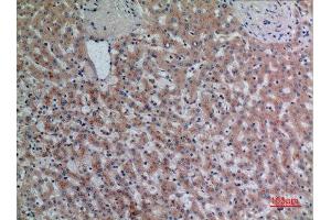 Immunohistochemistry (IHC) analysis of paraffin-embedded Human Liver, antibody was diluted at 1:100.