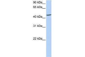 WB Suggested Anti-ICA1 Antibody Titration: 0. (ICA1 anticorps  (C-Term))