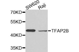 Western blot analysis of extracts of SW620 and Raji cells, using TFAP2B antibody. (TFAP2B anticorps)