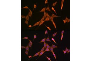 Immunofluorescence analysis of NIH-3T3 cells using RHOA/RHOB/RHOC Rabbit mAb (ABIN1678636, ABIN3019244, ABIN3019245 and ABIN7101735) at dilution of 1:100 (40x lens). (RhoA,B,C anticorps)