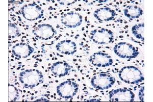 Image no. 8 for anti-B-Raf proto-oncogene, serine/threonine kinase (BRAF) antibody (ABIN1496954) (BRAF anticorps)