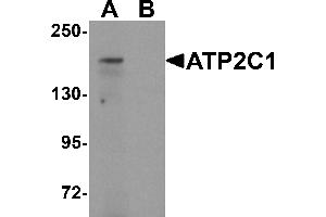 Western blot analysis of ATP2C1 in mouse brain tissue lysate with ATP2C1 antibody at 1 µg/mL in (A) the absence and (B) the presence of blocking peptide. (ATP2C1 anticorps  (C-Term))