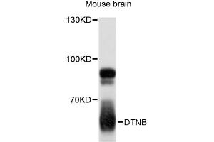 Western blot analysis of extracts of mouse brain, using DTNB antibody (ABIN6294202) at 1:3000 dilution. (Dystrobrevin beta anticorps)