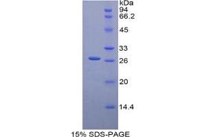 SDS-PAGE analysis of Mouse Glucuronidase beta Protein. (Glucuronidase beta Protéine)