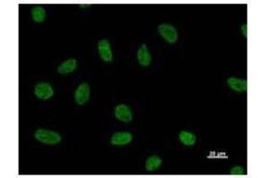 Immunostaining analysis in HeLa cells.