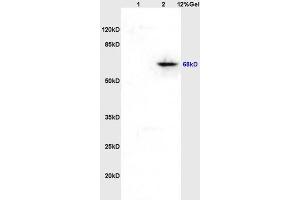 Lane 1: rat brain lysates Lane 2: rat heart lysates probed with Anti hospho-Paxillin (Tyr118) Polyclonal Antibody, Unconjugated (ABIN745043) at 1:200 in 4 °C. (Paxillin anticorps  (pTyr118))