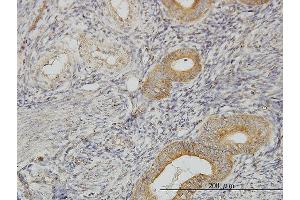 Immunoperoxidase of monoclonal antibody to FLJ20643 on formalin-fixed paraffin-embedded human endometrium.