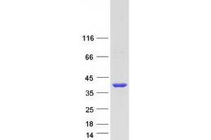 Validation with Western Blot